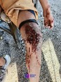 Motociclista lesionado en la carretera 500 frente a la penitenciaría