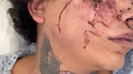 Paola Suárez sale del hospital tras ser agredida